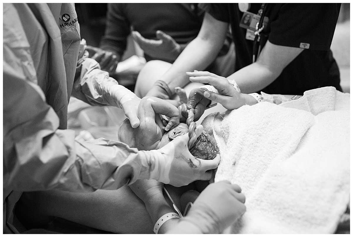 black and white image of nuchal cord during delivery at Banner Del Webb Hospital
